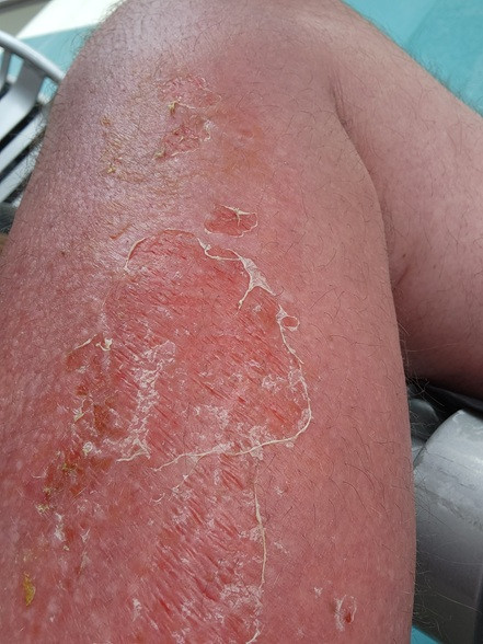 Click image for larger version

Name:	Day 6.jpg
Views:	67
Size:	92.0 KB
ID:	967