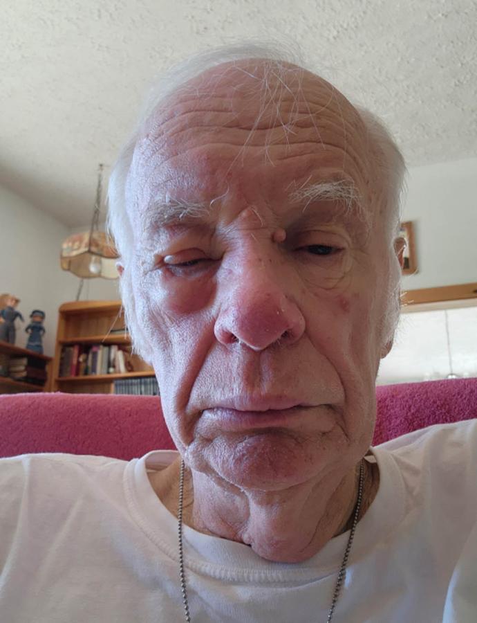 Click image for larger version

Name:	Pastor after the fight.jpg
Views:	99
Size:	63.2 KB
ID:	4494